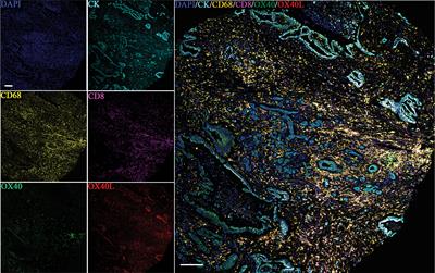 Frontiers | Analysis of the OX40/OX40L immunoregulatory axis combined ...